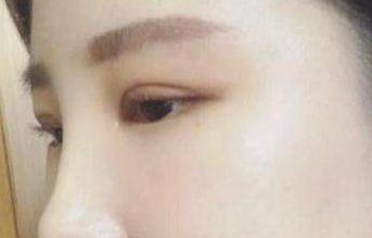 北京民航總醫(yī)院私密整形科的綜合評價