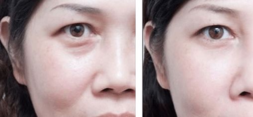 上海治療疤痕的醫(yī)院排名出爐！五家專業(yè)醫(yī)院實(shí)力震撼，趕快了解！