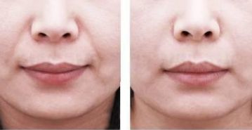 2023年南京熱門提升年輕外貌的知名醫(yī)師排行榜，更新當(dāng)?shù)貍涫苜澴u(yù)的專家醫(yī)生推薦詳細(xì)信息一覽