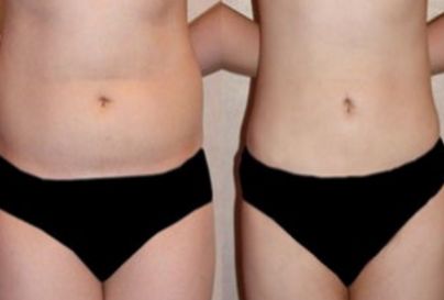 杭州哪家醫(yī)院是顴骨內(nèi)推領(lǐng)域的知名品牌？頂級醫(yī)院排行榜：浙江第一，浙江第二等梳理為參考