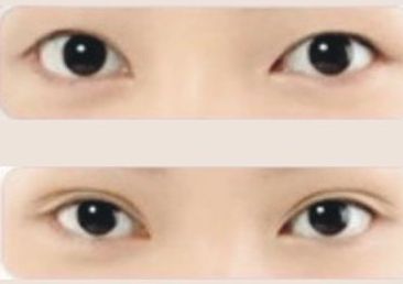 上海星璨整形醫(yī)院，專業(yè)提供驚艷隆鼻技術(shù)，擁有豐富的案例分享