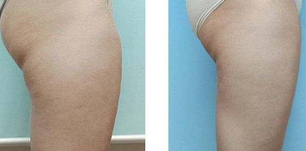 沈陽市哪家比較專業(yè)靠譜的隆鼻整形機構值得推薦？