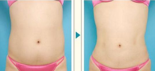 北京最受歡迎的美容院排名前三，熱門醫(yī)院名單不容錯(cuò)過！