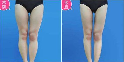 武漢哪家醫(yī)療機構(gòu)在正畸美容領(lǐng)域聲名顯赫？中山、美萊為佼佼者！