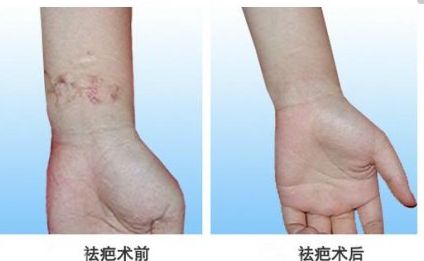 北京自體脂肪隆胸專家真實排行，專業(yè)技術精粹一同分享