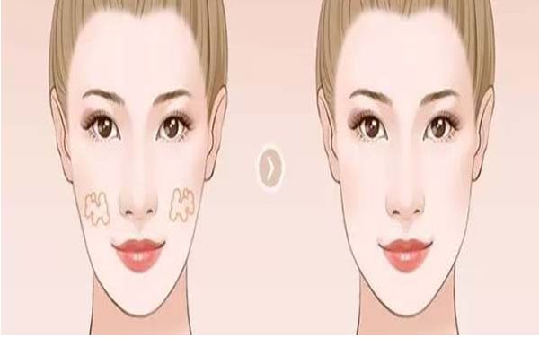 長沙鼻修復(fù)醫(yī)生推薦：權(quán)威名單及好口碑醫(yī)生合集