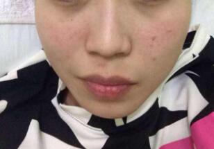 北京藝美醫(yī)療美容診所口碑怎么樣？有哪些值得推薦的醫(yī)生呢？