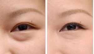 李鴻軍醫(yī)生點(diǎn)評(píng)：上?；颊叩谋亲诱谓?jīng)驗(yàn)分享