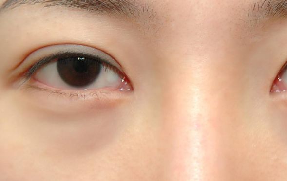 寧波臉部整形領域翹楚！頂尖雙眼皮醫(yī)生大揭秘