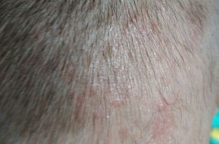 銀川奧蕊斯整形醫(yī)院震驚！驚艷面容煥然一新案例披露