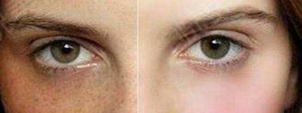 蘇薇潔與楊亞益對(duì)比，誰(shuí)能讓你的雙眼皮完美？實(shí)力專(zhuān)家比拼！