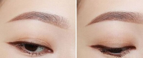 深圳最靠譜的整形美容醫(yī)院推薦，網(wǎng)友大力推薦，不容錯過