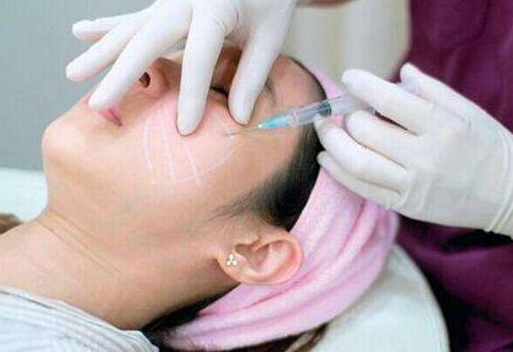 上海長(zhǎng)海醫(yī)院宋建星醫(yī)生：雙眼皮手術(shù)新體驗(yàn)，成功案例分享