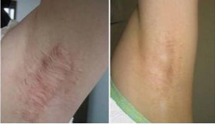 南京哪家醫(yī)院能夠完美實(shí)現(xiàn)雙眼皮手術(shù)的期望？