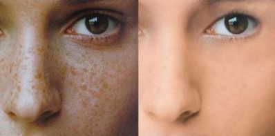 2023深圳市做隆胸手術(shù)的醫(yī)院排名及推薦