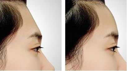 沈陽整形美容醫(yī)院鼻部整形?？祈敿?jí)醫(yī)院匯總，不容錯(cuò)過，速來圍觀