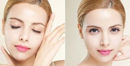 青島趙煜楠鼻修復(fù)案例分享-醫(yī)生秘笈曝光