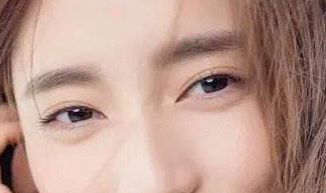 廈門盧藝樸：去眼袋術(shù)后驚艷臉龐，重拾年輕活力，醫(yī)生介紹鼎力推薦