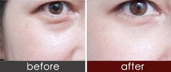 重點醫(yī)院盤點！西安脂肪抽取整形排行榜前十不容錯過！