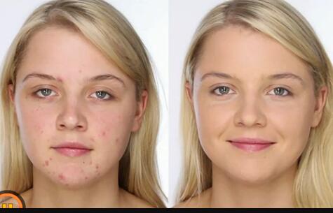 寧德醫(yī)美整形醫(yī)院哪家口碑比較好？雙眼皮價格查詢后的綜合評價如何？