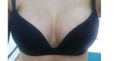 上海知名整形醫(yī)師盤點！這些隆鼻專家你不能錯過