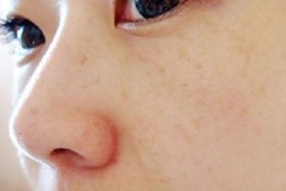 蘭州大學(xué)第二醫(yī)院私密整形部門案例揭示，充滿驚喜！