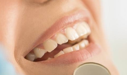 銀川哪家醫(yī)院有專業(yè)的熱瑪吉技術(shù)祛黑眼圈？2023年最新排名出爐，趕緊看看前十名單！