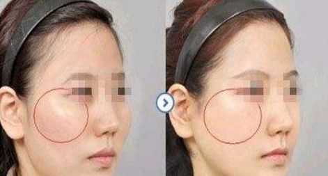 南京明星雙眼皮修復(fù)醫(yī)生排行榜2023，黃金龍、劉育鳳等著名專家入選！