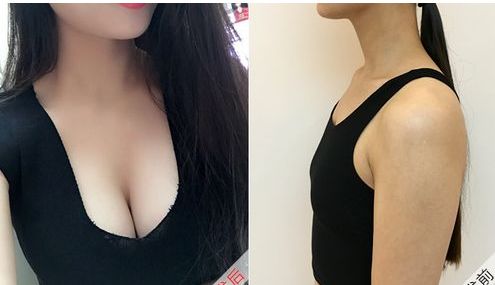 中國醫(yī)學科學院整形外科醫(yī)院李發(fā)成醫(yī)生的項目特長內容是什么？詳細資料及就診信息介紹