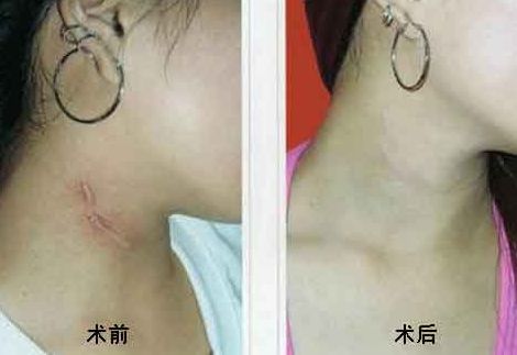 重慶乳房整形六大權(quán)威醫(yī)生盤點，高素質(zhì)專家排行曝光