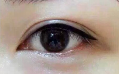 2023年四川明星雙眼皮專家全球發(fā)布丨郭祥文、郭波、肖海濤top5醫(yī)師介紹