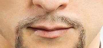 烏魯木齊市有口碑佳的整形醫(yī)院推薦！專業(yè)實(shí)力不容錯(cuò)過！