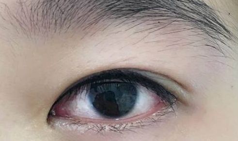 上海整形界最受歡迎的吸脂專(zhuān)家推薦，李耐國(guó)、曹衛(wèi)剛、李發(fā)成等醫(yī)生備受贊譽(yù)！附真實(shí)案例供參考