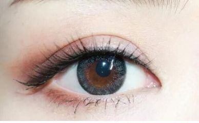 石家莊專家何靜雙眼皮技術(shù)如何？真人案例揭秘雙眼皮效果