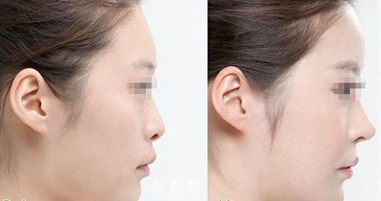 蘇州無線頻率融脂?？漆t(yī)生排名前十這幾位醫(yī)術聲譽超卓的醫(yī)生是您的不二之選