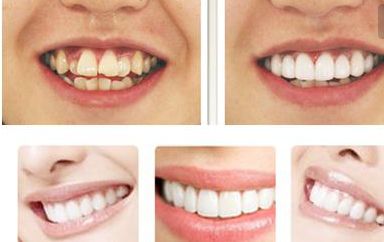 哪位醫(yī)生在北京最擅長鼻修復(fù)？不得不提的鼻整形專家！