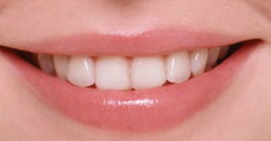 鄭州假體隆胸權(quán)威醫(yī)生推薦名單，值得信賴的選擇