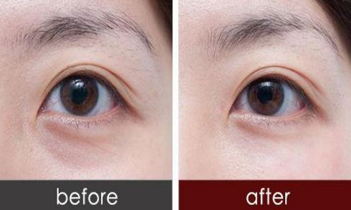 廣州荔灣人民醫(yī)院與中家醫(yī)整容醫(yī)院：醫(yī)療實(shí)力PK，看誰更勝一籌