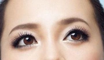 滕州美十美整形醫(yī)院分享雙眼整形經(jīng)驗，幫你輕松擁有雙眼皮！