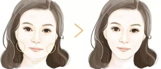 北京黎星醫(yī)生的面部脂肪填充效果如何？真實案例揭秘！