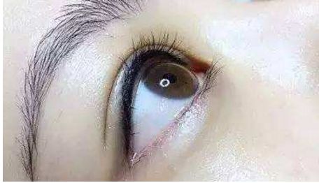 長沙哪位醫(yī)生在雙眼皮修復(fù)技術(shù)上口碑好找排名靠前的？