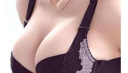 北京王光輝雙眼皮術(shù)后半年感受大揭秘！