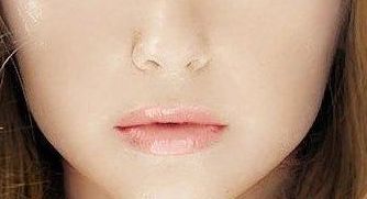 王維九院的雙眼皮修復(fù)技術(shù)值得信賴嗎？專家實力與成功案例給出參考