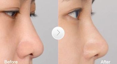 高效祛疤地，推薦的整形醫(yī)院在廣州！更有名口碑榜單盤點