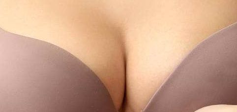 上海美萊診所-專家技術(shù)綜合評析及隆胸案例分享