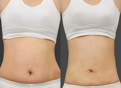 私房，讓您的整形開心！草莓、燦爛，汕頭市頂級整形醫(yī)院歡迎您！