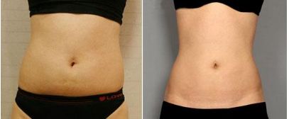 錦州美容整形科專家介紹及收費(fèi)明細(xì)表完善！