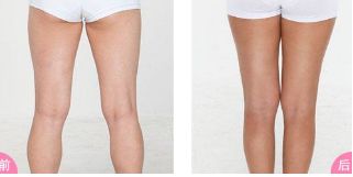 鄭州修復(fù)雙眼皮的專家推薦！這些醫(yī)院排名靠前、信譽(yù)有保障