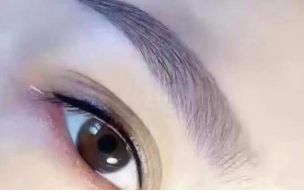 廣州治療內(nèi)眼角凹陷，選擇這幾家醫(yī)院最靠譜