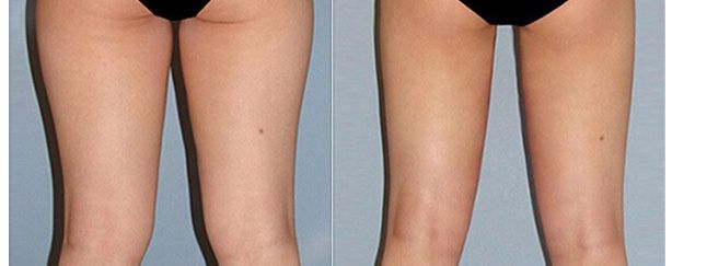 溧陽(yáng)市眼科專(zhuān)家就診推薦，醫(yī)生名單及治療費(fèi)用一覽